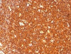 HLA DRB1 Antibody (SPM289), Novus Biologicals:Antibodies:Primary Antibodies