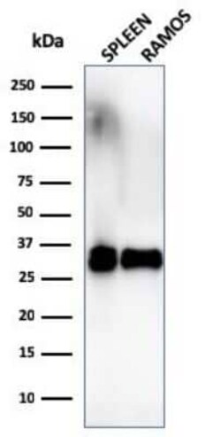 HLA DRB1 Antibody (SPM289), Novus Biologicals:Antibodies:Primary Antibodies