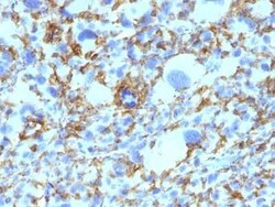 HLA DRB1 Antibody (SPM423), Novus Biologicals:Antibodies:Primary Antibodies