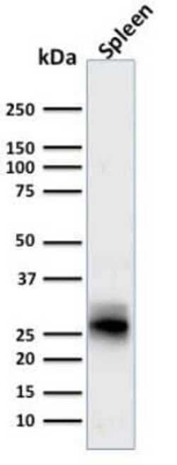 HLA DRB1 Antibody (SPM423), Novus Biologicals:Antibodies:Primary Antibodies