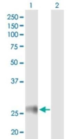 HLA DRB4 Antibody, Novus Biologicals 50 &mu;g | Buy Online | Novus Biologicals | Fisher Scientific