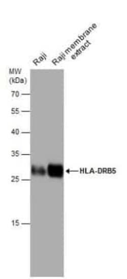 HLA DRB5 Antibody, Novus Biologicals 100 &mu;g | Buy Online | Novus Biologicals | Fisher Scientific