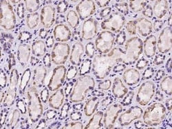 HLCS Antibody, Novus Biologicals 50 &mu;g, Unconjugated:Antibodies, Polyclonal