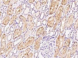 HLCS Antibody, Novus Biologicals 100 &mu;g | Buy Online | Novus Biologicals | Fisher Scientific