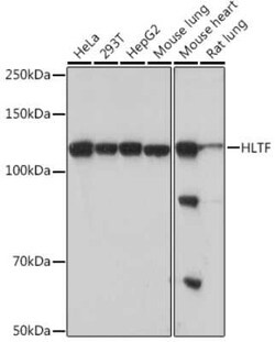 HLTF Rabbit anti-Human, Mouse, Rat, Clone: 8T0I2, Novus Biologicals 20