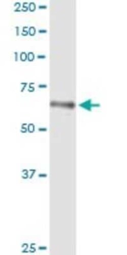 HLX1 Antibody (1B9), Novus Biologicals 0.1 mg | Buy Online | Novus Biologicals | Fisher Scientific
