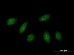 HLX1 Antibody, Novus Biologicals 0.05 mg | Buy Online | Novus Biologicals | Fisher Scientific