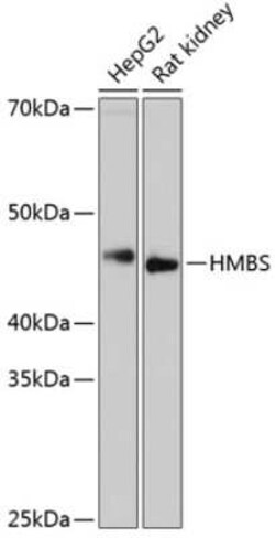 HMBS Rabbit anti-Human, Mouse, Rat, Clone: 9T8Z9, Novus Biologicals 100 &mu;g | Buy Online | Bio-Techne | Fisher Scientific