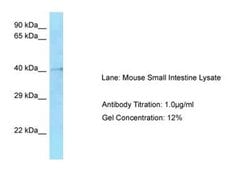 HMCES Antibody, Novus Biologicals 100 &mu;L; Unconjugated:Antibodies, Polyclonal