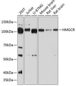 HMG-CoA Reductase/HMGCR Rabbit anti-Human, Mouse, Rat, Clone: 6Y9L8, Novus