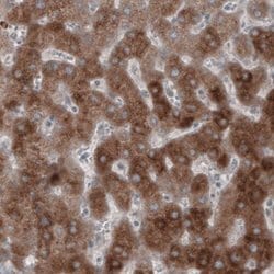 HMG-CoA Reductase/HMGCR Antibody (CL0259), Novus Biologicals:Antibodies:Primary
