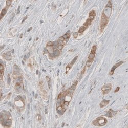 HMG-CoA Reductase/HMGCR Antibody (CL0259), Novus Biologicals:Antibodies:Primary