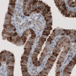 HMG-CoA Reductase/HMGCR Antibody (CL0259), Novus Biologicals:Antibodies:Primary