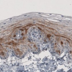 HMG-CoA Reductase/HMGCR Antibody (CL0259), Novus Biologicals:Antibodies:Primary