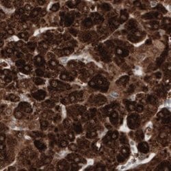 HMG-CoA Reductase/HMGCR Antibody (CL0259), Novus Biologicals:Antibodies:Primary