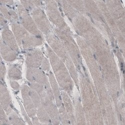 HMG-CoA Reductase/HMGCR Antibody (CL0259), Novus Biologicals:Antibodies:Primary