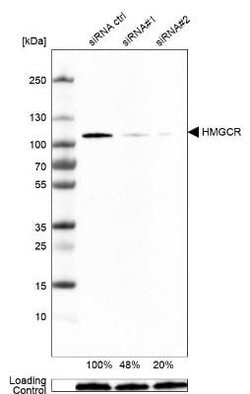 HMG-CoA Reductase/HMGCR Antibody (CL0259), Novus Biologicals:Antibodies:Primary