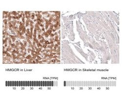 HMG-CoA Reductase/HMGCR Antibody (CL0260), Novus Biologicals 100&mu;L:Antibodies,