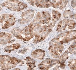 HMG-CoA Reductase/HMGCR Antibody (CL0260), Novus Biologicals 100&mu;L:Antibodies,