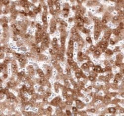 HMG-CoA Reductase/HMGCR Antibody (CL0260), Novus Biologicals 100&mu;L:Antibodies,