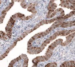 HMG-CoA Reductase/HMGCR Antibody (CL0260), Novus Biologicals 100&mu;L:Antibodies,