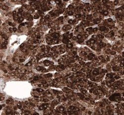 HMG-CoA Reductase/HMGCR Antibody (CL0260), Novus Biologicals 100&mu;L:Antibodies,