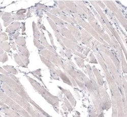 HMG-CoA Reductase/HMGCR Antibody (CL0260), Novus Biologicals 100&mu;L:Antibodies,