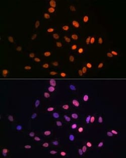 HMGA1 Rabbit anti-Human, Mouse, Rat, Clone: 5J0E6, Novus Biologicals 20 &mu;g | Buy Online | Bio-Techne | Fisher Scientific