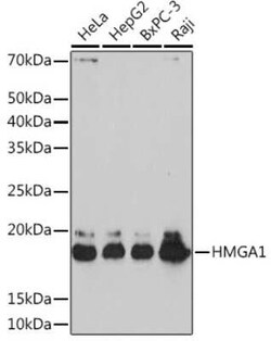 HMGA1 Rabbit anti-Human, Mouse, Rat, Clone: 5J0E6, Novus Biologicals 20 &mu;g | Buy Online | Bio-Techne | Fisher Scientific