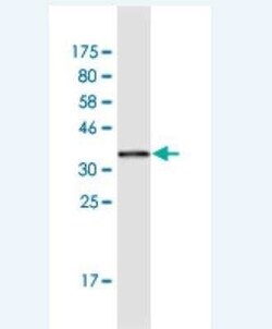 HMGA1 Antibody (2A1), Novus Biologicals 0.1 mg | Buy Online | Novus Biologicals | Fisher Scientific