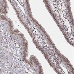 HMGA2 Antibody, Novus Biologicals 0.1 mL, Unconjugated:Antibodies, Polyclonal