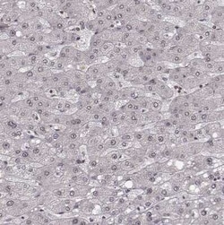 HMGA2 Antibody, Novus Biologicals 0.1 mL, Unconjugated:Antibodies, Polyclonal