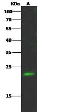 HMGA2 Antibody, Novus Biologicals:Anticuerpos:Anticuerpos primarios