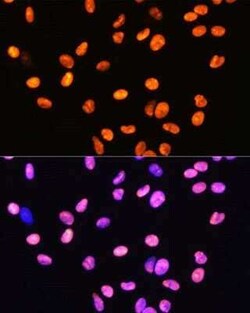 HMGB1/HMG-1 Rabbit anti-Human, Mouse, Rat, Clone: 1C4T5, Novus Biologicals