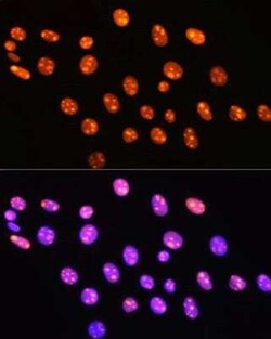 HMGB1/HMG-1 Rabbit anti-Human, Mouse, Rat, Clone: 1C4T5, Novus Biologicals