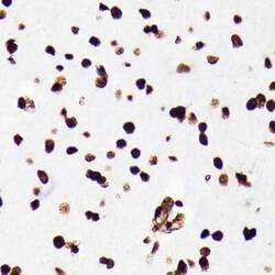 HMGB1/HMG-1 Rabbit anti-Human, Mouse, Rat, Clone: 1C4T5, Novus Biologicals