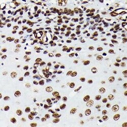 HMGB1/HMG-1 Rabbit anti-Human, Mouse, Rat, Clone: 1C4T5, Novus Biologicals