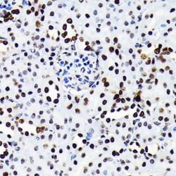 HMGB1/HMG-1 Rabbit anti-Human, Mouse, Rat, Clone: 1C4T5, Novus Biologicals