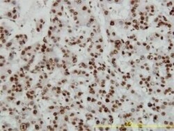 HMGB1/HMG-1 Antibody (1D5), Novus Biologicals 0.1 mg | Buy Online | Novus Biologicals | Fisher Scientific