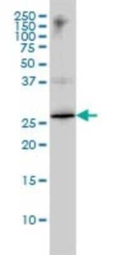 HMGB1/HMG-1 Antibody (1D5), Novus Biologicals 0.1 mg | Buy Online | Novus Biologicals | Fisher Scientific