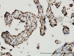 HMGB1/HMG-1 Antibody (2F6), Novus Biologicals 0.1 mg | Buy Online | Novus Biologicals | Fisher Scientific