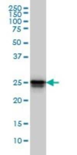 HMGB1/HMG-1 Antibody (2F6), Novus Biologicals 0.1 mg | Buy Online | Novus Biologicals | Fisher Scientific