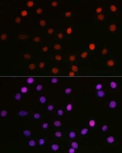 HMGB1/HMG-1 Rabbit anti-Human, Mouse, Rat, Polyclonal, Novus Biologicals