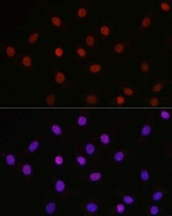 HMGB1/HMG-1 Rabbit anti-Human, Mouse, Rat, Polyclonal, Novus Biologicals