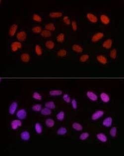 HMGB1/HMG-1 Rabbit anti-Human, Mouse, Rat, Polyclonal, Novus Biologicals