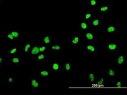 HMGB2 Antibody (3E5), Novus Biologicals 0.1 mg, Unconjugated:Antibodies,