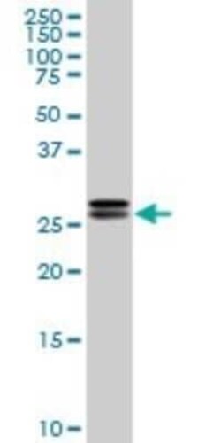 HMGB2 Antibody (3E5), Novus Biologicals 0.1 mg, Unconjugated:Antibodies,