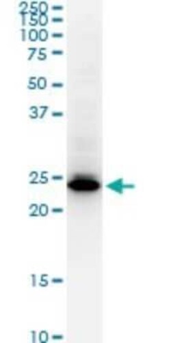 HMGB2 Antibody (3F2), Novus Biologicals 0.1 mg | Buy Online | Novus Biologicals | Fisher Scientific