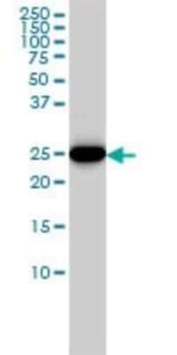 Novus Biologicals HMGB2 Antibody (4G7), Novus Biologicals 0.1 mg | Buy Online | Novus Biologicals&trade; | Fisher Scientific