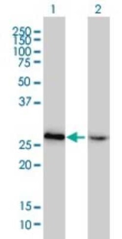 Novus Biologicals HMGB2 Antibody (4G7), Novus Biologicals 0.1 mg | Buy Online | Novus Biologicals&trade; | Fisher Scientific